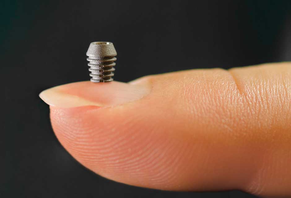 slider-implant-01